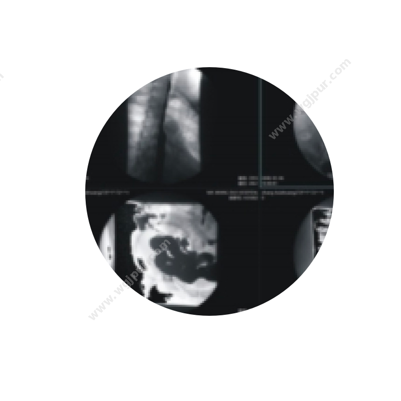 联晰医疗 LIANXI-PACS（软件+硬件） 放射影像