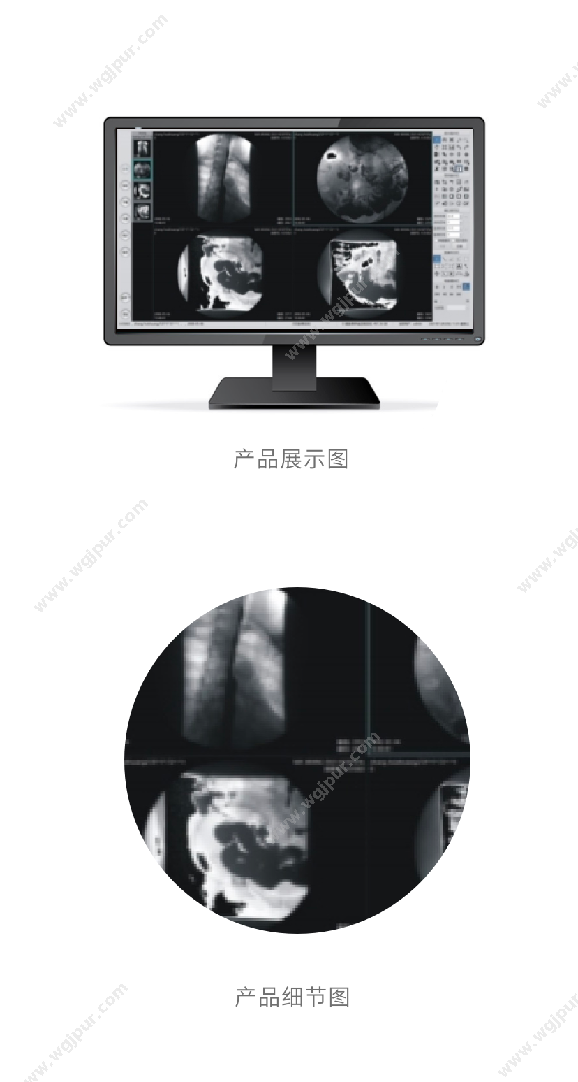 联晰医疗 LIANXI-PACS（软件+硬件） 放射影像