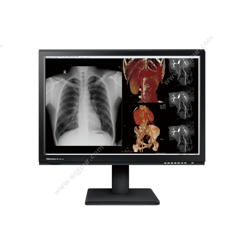 海信医疗6兆彩色诊断显示器 HMD6C30D放射影像