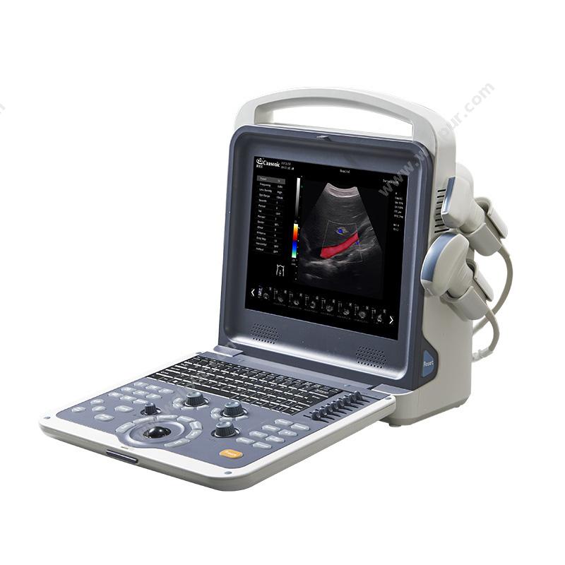 科美达 Cansonic全数字彩色多普勒超声诊断仪 K2（标配腹部探头）彩超