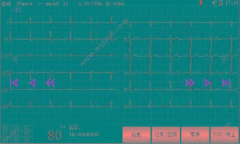 瑞博 数字式心电图机 ECG一8203（动物用） 心电图机