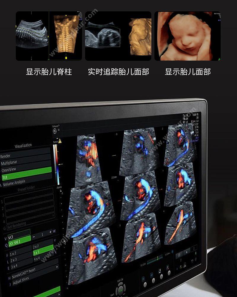 GE医疗 彩色超声诊断仪 VOLUSON S6（腹部C1+心脏3SC+浅表12L） 彩超