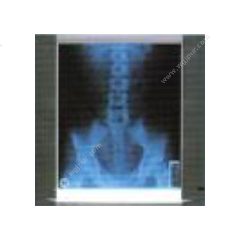 大维同创X射线胶片观片灯GP-G1（Ⅰ联 固定亮度）观片灯